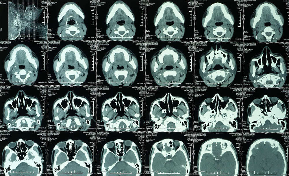 Advanced Multislice CT Scan